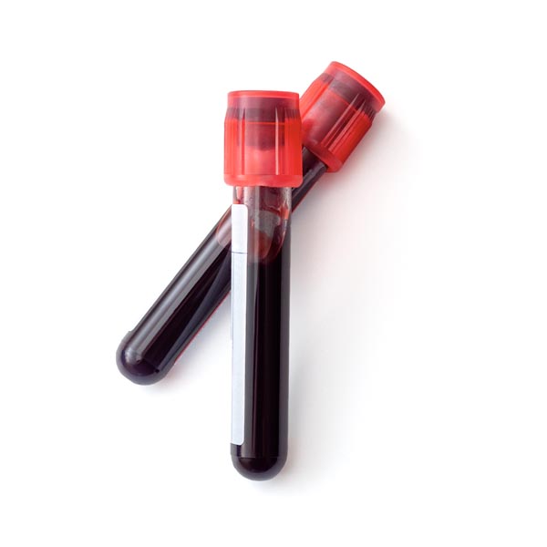 Two vials of blood representing the 10X Health System Blood Testing