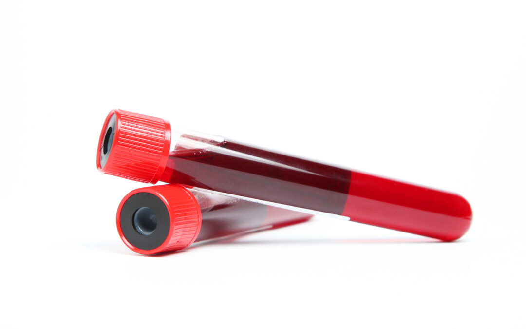 What Blood Testing Can Tell You About Your Health