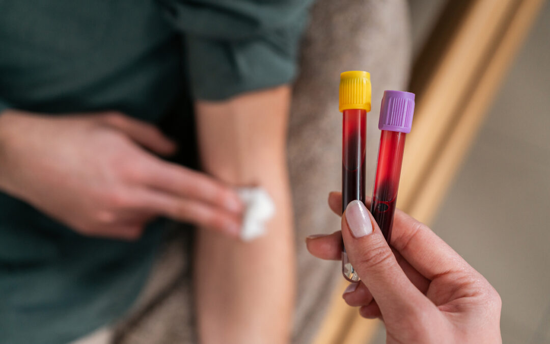 How Often Should I Get a Blood Test?