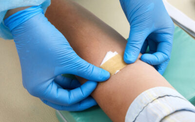 How To Prepare For a Blood Test