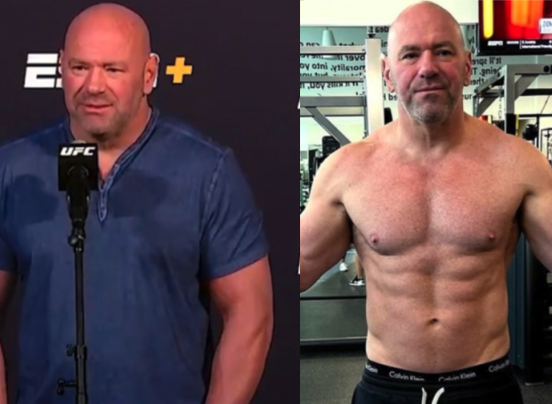 Dana White before and after