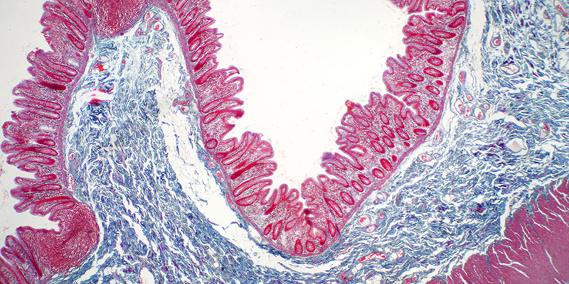 graphic of Occludin, a key marker detected by the 10X Health Gut Health Test